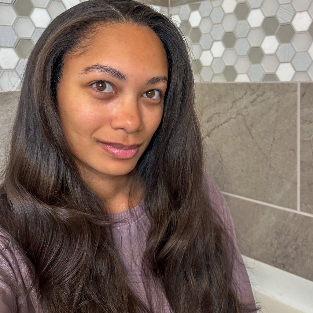 My skin in my&nbsp;30s